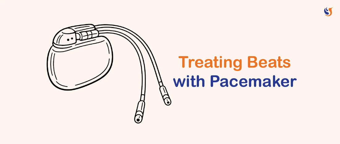 How The Pacemaker Was Invented